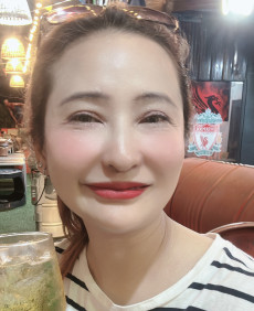 Napat photo