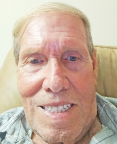 Randal photo